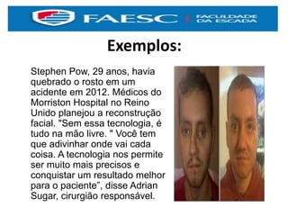 Exemplos:
Stephen Pow, 29 anos, havia
quebrado o rosto em um
acidente em 2012. Médicos do
Morriston Hospital no Reino
Unido planejou a reconstrução
facial. "Sem essa tecnologia, é
tudo na mão livre. " Você tem
que adivinhar onde vai cada
coisa. A tecnologia nos permite
ser muito mais precisos e
conquistar um resultado melhor
para o paciente”, disse Adrian
Sugar, cirurgião responsável.
 