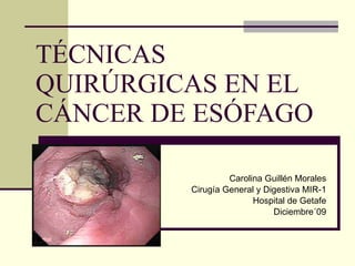 TÉCNICAS QUIRÚRGICAS EN EL CÁNCER DE ESÓFAGO Carolina Guillén Morales Cirugía General y Digestiva MIR-1 Hospital de Getafe Diciembre´09 