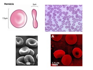 Hemácia 7,5 μ m 2 μ m 