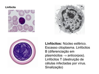 Linfócito Linfócitos:  Núcleo esférico. Escasso citoplasma. Linfócitos B (diferenciação em plasmócitos    anticorpos). Linfócitos T (destruição de células infectadas por vírus. Sinalização) 
