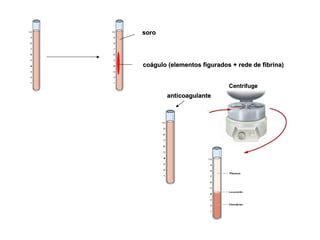 soro coágulo (elementos figurados + rede de fibrina) anticoagulante 