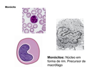 Monócito Monócitos:  Núcleo em forma de rim. Precursor de macrófago 