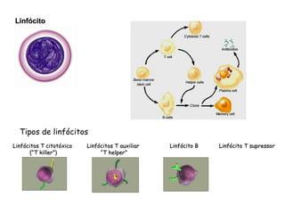 Linfócito Tipos de linfócitos Linfócitos T citotóxico  (“T killer”) Linfócitos T auxiliar  “ T helper” Linfócito B Linfócito T supressor 