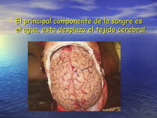 • El principal componente de la sangre esEl principal componente de la sangre es
el agua, esta desplaza el tejido cerebral.el agua, esta desplaza el tejido cerebral.
 
