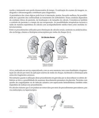 receba o tratamento sem perda desnecessária de tempo. A realização de exames de imagem, ra-
diografia e ultrassonografia contribuem para diagnóstico.
A persistência das crises álgicas pode levar à internação, porém, havendo melhora, há possibili-
dade de o paciente dar continuidade ao tratamento em ambulatório. Essas condutas dependem
da condição clínica do paciente, da localização e do tamanho do cálculo. Considera-se também
o conforto do paciente e o tempo de sua recuperação. As possibilidades terapêuticas incluem a
saída de maneira espontânea do cálculo com acompanhamento médico bem como medidas in-
tervencionistas.
Entre os procedimentos utilizados para eliminação de cálculos renais, ureterais ou ainda localiza-
dos na bexiga, citamos a litotripsia extracorpórea por ondas de choque (leco).

                                                 Os Cálculos Renais




                              Pedras “simples”                         Pedras menores
                            são muitos grandes                         saem do organismo
                                   para saírem                         pela urina


                                                  Ondas de ultrassom
                                                  quebram as pedras


A leco, realizada em serviço especializado, com ou sem anestesia, tem como finalidade a fragmen-
tação do cálculo por meio da aplicação externa de ondas de choque, facilitando a eliminação pela
urina dos fragmentos arenosos.
Há restrições quanto à utilização desse procedimento em grávidas por se desconhecer os efeitos de-
letérios ao feto e a possibilidade de ocasionar descolamento prematuro da placenta. Pacientes com
quadro de coagulopatias ou de infecção urinária com repercussão hemodinâmica também estão
impedidos de realizar esse procedimento.
Os cálculos maiores que 2 cm podem ser removidos por meio de procedimentos percutâneos, por
via endoscópica ou laparoscópica.




              Nefrolitotripsia                                                   Ureterolitotripsia
           transnefroscópica                                                     transureteroscópica

116
 