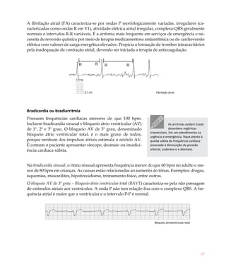 A fibrilação atrial (FA) caracteriza-se por ondas P morfologicamente variadas, irregulares (ca-
racterizadas como ondas R em V1), atividade elétrica atrial irregular, complexo QRS geralmente
normais e intervalos R-R variáveis. É a arritmia mais frequente em serviços de emergência e ne-
cessita de reversão química por meio de terapia medicamentosa antiarrítmica ou de cardioversão
elétrica com valores de carga energética elevados. Propicia a formação de trombos intracavitários
pela inadequação de contração atrial, devendo ser iniciada a terapia de anticoagulação.




                                                                        Fibrilação atrial




Bradicardia ou bradiarritmia
Possuem frequências cardíacas menores do que 100 bpm.
Incluem bradicardia sinusal e bloqueio átrio ventricular (AV)                      As arritmias podem trazer
de 1º, 2º e 3º grau. O bloqueio AV de 3º grau, denominado                          desordens orgânicas
                                                                    irreversíveis. Em um atendimento na
bloqueio átrio ventricular total, é o mais grave de todos,
                                                                    urgência e emergência, fique atento à
porque nenhum dos impulsos atriais estimula o nódulo AV.            queda súbita da frequência cardíaca
É comum o paciente apresentar síncope, desmaio ou insufici-         associada à diminuição da pressão
ência cardíaca súbita.                                              arterial, sudorese e o desmaio.



Na bradicardia sinusal, o ritmo sinusal apresenta frequência menor do que 60 bpm no adulto e me-
nor de 80 bpm em crianças. As causas estão relacionadas ao aumento do tônus. Exemplos: drogas,
isquemias, miocardites, hipotireoidismo, treinamento físico, entre outros.
O bloqueio AV de 3º grau – Bloqueio átrio ventricular total (BAVT) caracteriza-se pela não passagem
de estímulos atriais aos ventrículos. A onda P não tem relação fixa com o complexo QRS. A fre-
quência atrial é maior que a ventricular e o intervalo P-P é normal.




                                                                       Bloqueio atrioventricular total




                                                                                                         87
 
