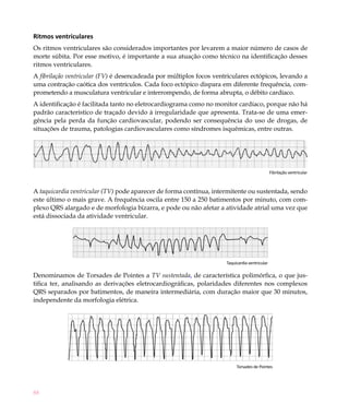 Ritmos ventriculares
Os ritmos ventriculares são considerados importantes por levarem a maior número de casos de
morte súbita. Por esse motivo, é importante a sua atuação como técnico na identificação desses
ritmos ventriculares.
A fibrilação ventricular (FV) é desencadeada por múltiplos focos ventriculares ectópicos, levando a
uma contração caótica dos ventrículos. Cada foco ectópico dispara em diferente frequência, com-
prometendo a musculatura ventricular e interrompendo, de forma abrupta, o débito cardíaco.
A identificação é facilitada tanto no eletrocardiograma como no monitor cardíaco, porque não há
padrão característico de traçado devido à irregularidade que apresenta. Trata-se de uma emer-
gência pela perda da função cardiovascular, podendo ser consequência do uso de drogas, de
situações de trauma, patologias cardiovasculares como síndromes isquêmicas, entre outras.




                                                                                               Fibrilação ventricular



A taquicardia ventricular (TV) pode aparecer de forma contínua, intermitente ou sustentada, sendo
este último o mais grave. A frequência oscila entre 150 a 250 batimentos por minuto, com com-
plexo QRS alargado e de morfologia bizarra, e pode ou não afetar a atividade atrial uma vez que
está dissociada da atividade ventricular.




                                                                     Taquicardia ventricular

Denominamos de Torsades de Pointes a TV sustentada, de característica polimórfica, o que jus-
tifica ter, analisando as derivações eletrocardiográficas, polaridades diferentes nos complexos
QRS separados por batimentos, de maneira intermediária, com duração maior que 30 minutos,
independente da morfologia elétrica.




                                                                          Torsades de Pointes




88
 