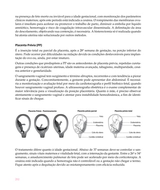 252
na presença de feto morto ou inviável para a idade gestacional, com monitoração dos parâmetros
clínicos maternos; após este período está indicada a cesárea. O rompimento das membranas ovu-
lares é imediato para acelerar ou promover o trabalho de parto, diminuir a embolia por líquido
amniótico, hemorragia e risco de coagulação intravascular disseminada. A delimitação da área
do descolamento, objetivando sua contenção, é necessária. A histerectomia só é realizada quando
há atonia uterina não solucionada por outros métodos.
Placenta Prévia (PP)
É a inserção total ou parcial da placenta, após a 28ª semana de gestação, na porção inferior do
útero. Pode ocorrer por dificuldades na nidação devido às condições desfavoráveis para implan-
tação do ovo ou, ainda, por estar imaturo.
Outras condições que predispõem a PP são os antecedentes de placenta prévia, repetidas cureta-
gens e presença de cicatrizes uterinas, idade materna avançada, tabagismo, multiparidade, cesá-
rea anterior e gemelaridade.
O sangramento vaginal tem surgimento e término abruptos, recorrentes e com tendência a piorar
durante a gestação. Concomitantemente, a gestante pode apresentar dor abdominal. É necessá-
ria a monitorização e avaliação fetal por meio da cardiotocografia e perfil biofísico fetal, quando
houver sangramento vaginal profuso. A ultrassonografia obstétrica é o exame complementar de
maior relevância para a visualização da posição placentária. Quanto à mãe, é preciso observar
atentamente o sangramento vaginal e atentar para instabilidade hemodinâmica, a fim de identi-
ficar sinais de choque.
Placenta Prévia - Posicionamento Placenta prévia parcial Placenta prévia total
FetoFeto
EndométrioEndométrio
PlacentaPlacenta
Colo do úteroColo do útero
Cordão UmbilicalCordão Umbilical
O tratamento difere quanto à idade gestacional. Abaixo de 37 semanas deve-se controlar o san-
gramento, sinais vitais maternos e vitalidade fetal, com a internação da gestante. Entre a 26ª e 34ª
semanas, o amadurecimento pulmonar do feto pode ser acelerado por meio da corticoterapia. A
cesárea está indicada quando a hemorragia não é controlável ou a gestação não chegar a termo.
Fique atento após a dequitação devido ao miotamponamento com eficácia reduzida.
 