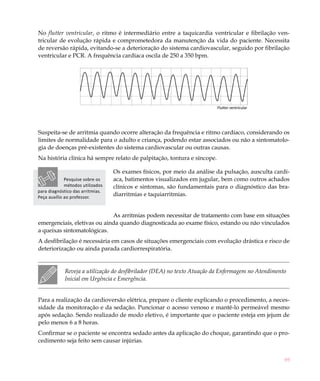 89
No flutter ventricular, o ritmo é intermediário entre a taquicardia ventricular e fibrilação ven-
tricular de evolução rápida e comprometedora da manutenção da vida do paciente. Necessita
de reversão rápida, evitando-se a deterioração do sistema cardiovascular, seguido por fibrilação
ventricular e PCR. A frequência cardíaca oscila de 250 a 350 bpm.
Flutter ventricular
Suspeita-se de arritmia quando ocorre alteração da frequência e ritmo cardíaco, considerando os
limites de normalidade para o adulto e criança, podendo estar associados ou não a sintomatolo-
gia de doenças pré-existentes do sistema cardiovascular ou outras causas.
Na história clínica há sempre relato de palpitação, tontura e síncope.
Os exames físicos, por meio da análise da pulsação, ausculta cardí-
aca, batimentos visualizados em jugular, bem como outros achados
clínicos e sintomas, são fundamentais para o diagnóstico das bra-
diarritmias e taquiarritmias.
As arritmias podem necessitar de tratamento com base em situações
emergenciais, eletivas ou ainda quando diagnosticada ao exame físico, estando ou não vinculados
a queixas sintomatológicas.
A desfibrilação é necessária em casos de situações emergenciais com evolução drástica e risco de
deteriorização ou ainda parada cardiorrespiratória.
Reveja a utilização do desfibrilador (DEA) no texto Atuação da Enfermagem no Atendimento
Inicial em Urgência e Emergência.
Para a realização da cardioversão elétrica, prepare o cliente explicando o procedimento, a neces-
sidade da monitoração e da sedação. Puncionar o acesso venoso e mantê-lo permeável mesmo
após sedação. Sendo realizado de modo eletivo, é importante que o paciente esteja em jejum de
pelo menos 6 a 8 horas.
Confirmar se o paciente se encontra sedado antes da aplicação do choque, garantindo que o pro-
cedimento seja feito sem causar injúrias.
Pesquise sobre os
métodos utilizados
para diagnóstico das arritmias.
Peça auxílio ao professor.
 