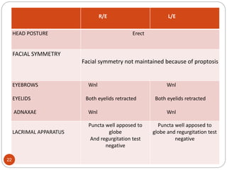 R/E L/E
HEAD POSTURE Erect
FACIAL SYMMETRY
Facial symmetry not maintained because of proptosis
EYEBROWS
EYELIDS
ADNAXAE
Wnl
Both eyelids retracted
Wnl
Wnl
Both eyelids retracted
Wnl
LACRIMAL APPARATUS
Puncta well apposed to
globe
And regurgitation test
negative
Puncta well apposed to
globe and regurgitation test
negative
22
 