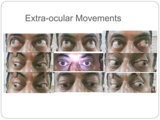 Extra-ocular Movements
 