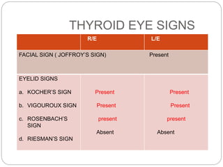 R/E L/E
EYELID SIGNS
a. KOCHER’S SIGN
b. VIGOUROUX SIGN
c. ROSENBACH’S
SIGN
d. RIESMAN’S SIGN
Present
Present
present
Absent
Present
Present
present
Absent
THYROID EYE SIGNS
FACIAL SIGN ( JOFFROY’S SIGN) Present
 