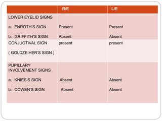 R/E L/E
LOWER EYELID SIGNS
a. ENROTH’S SIGN
b. GRIFFITH’S SIGN
Present
Absent
Present
Absent
CONJUCTIVAL SIGN
( GOLDZEIHER’S SIGN )
present present
PUPILLARY
INVOLVEMENT SIGNS
a. KNIES’S SIGN
b. COWEN’S SIGN
Absent
Absent
Absent
Absent
 