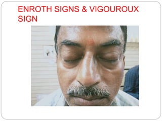 ENROTH SIGNS & VIGOUROUX
SIGN
 