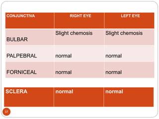 37
CONJUNCTIVA RIGHT EYE LEFT EYE
BULBAR
Slight chemosis Slight chemosis
PALPEBRAL normal normal
FORNICEAL normal normal
SCLERA normal normal
 