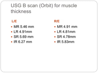 USG B scan (Orbit) for muscle
thickness
L/E R/E
 MR 5.46 mm
 LR 4.91mm
 SR 5.69 mm
 IR 6.27 mm
 MR 4.91 mm
 LR 4.81mm
 SR 4.78mm
 IR 5.83mm
 