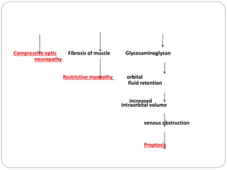 Compressive optic Fibrosis of muscle Glycosaminoglycan
neuropathy
Restrictive myopathy orbital
fluid retention
increased
intraorbital volume
venous obstruction
Proptosis
 