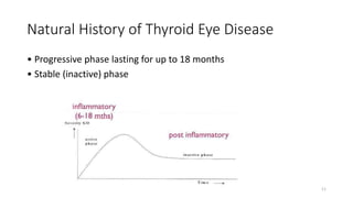 Natural History of Thyroid Eye Disease
• Progressive phase lasting for up to 18 months
• Stable (inactive) phase
11
 