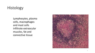 Histology
Lymphocytes, plasma
cells, macrophages
and mast cells
infiltrate extraocular
muscles, fat and
connective tissue
9
 