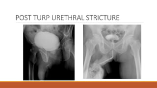 Comprehensive Imaging Techniques and Evaluation of Urethral Disorders ...