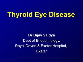 Thyroid Eye Disease Dr Bijay Vaidya Dept of Endocrinology, Royal Devon & Exeter Hospital,  Exeter 