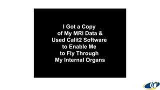 I Got a Copy
of My MRI Data &
Used Calit2 Software
to Enable Me
to Fly Through
My Internal Organs
 