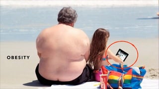 O B E S I T Y
 