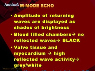 Amplitude of returning waves are displayed as shades of brightness Blood filled chambers   no reflected waves   BLACK Valve tissue and myocardium    high reflected wave activity   grey/white ..\pdfnotes\Pocket Atlas of Echocardiography.pdf 