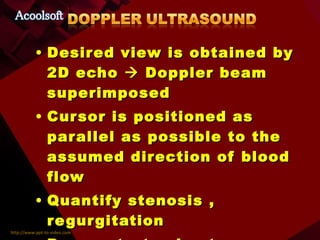Desired view is obtained by 2D echo    Doppler beam superimposed Cursor is positioned as parallel as possible to the assumed direction of blood flow Quantify stenosis , regurgitation Demonstrate shunts ..\videos\video.flv 