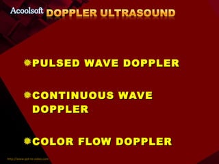 PULSED WAVE DOPPLER CONTINUOUS WAVE DOPPLER COLOR FLOW DOPPLER 