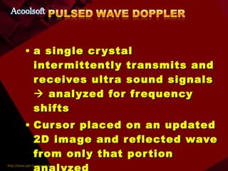 a single crystal intermittently transmits and receives ultra sound signals    analyzed for frequency shifts Cursor placed on an updated 2D image and reflected wave from only that portion analyzed 