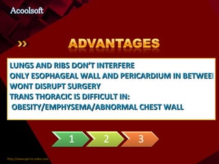 LUNGS AND RIBS DON’T INTERFERE ONLY ESOPHAGEAL WALL AND PERICARDIUM IN BETWEEN WONT DISRUPT SURGERY TRANS THORACIC IS DIFFICULT IN:  OBESITY/EMPHYSEMA/ABNORMAL CHEST WALL   