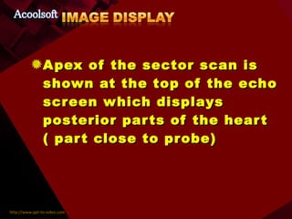 Apex of the sector scan is shown at the top of the echo screen which displays posterior parts of the heart ( part close to probe) 