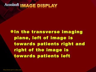 In the transverse imaging plane, left of image is towards patients right and right of the image is towards patients left 