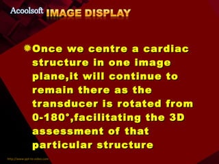 Once we centre a cardiac structure in one image plane,it will continue to remain there as the transducer is rotated from 0-180°,facilitating the 3D assessment of that particular structure 