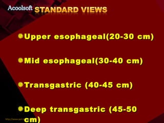 Upper esophageal(20-30 cm) Mid esophageal(30-40 cm) Transgastric (40-45 cm) Deep transgastric (45-50 cm) 