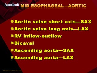 Aortic valve short axis—SAX Aortic valve long axis—LAX RV inflow-outflow Bicaval Ascending aorta—SAX Ascending aorta—LAX  