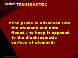 The probe is advanced into the stomach and ante  flexed ( to keep it apposed to the diaphragmatic surface of stomach) 