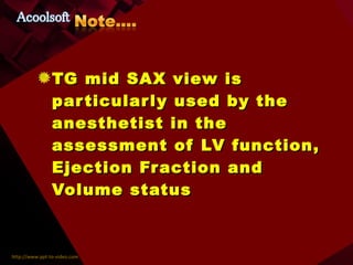TG mid SAX view is particularly used by the anesthetist in the assessment of LV function, Ejection Fraction and Volume status 