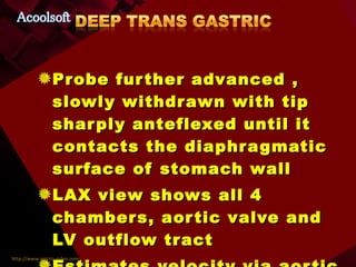 Probe further advanced , slowly withdrawn with tip sharply anteflexed until it contacts the diaphragmatic surface of stomach wall LAX view shows all 4 chambers, aortic valve and LV outflow tract Estimates velocity via aortic valve and CO 