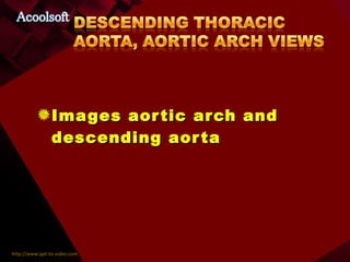 Images aortic arch and descending aorta  
