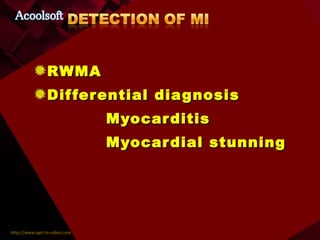 RWMA Differential diagnosis Myocarditis Myocardial stunning 