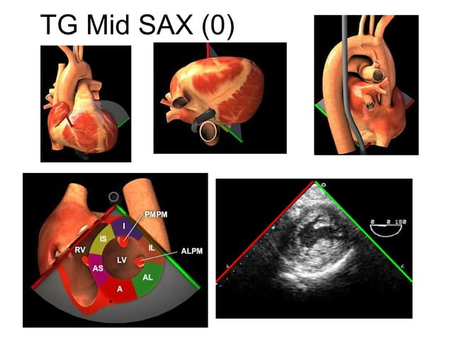 Trans esophageal echocardiography (TEE) orientation | PPT | Heart and ...