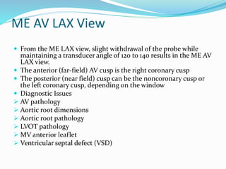 ME AV LAX View
 From the ME LAX view, slight withdrawal of the probe while
maintaining a transducer angle of 120 to 140 results in the ME AV
LAX view.
 The anterior (far-field) AV cusp is the right coronary cusp
 The posterior (near field) cusp can be the noncoronary cusp or
the left coronary cusp, depending on the window
 Diagnostic Issues
 AV pathology
 Aortic root dimensions
 Aortic root pathology
 LVOT pathology
 MV anterior leaflet
 Ventricular septal defect (VSD)
 