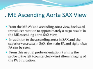 . ME Ascending Aorta SAX View
 From the ME AV and ascending aorta view, backward
transducer rotation to approximately 0 to 30 results in
the ME ascending aorta SAX view.
 In addition to the ascending aorta in SAX and the
superior vena cava in SAX, the main PA and right lobar
PA can be seen.
 From this neutral probe orientation, turning the
probe to the left (counterclockwise) allows imaging of
the PA bifurcation.
 