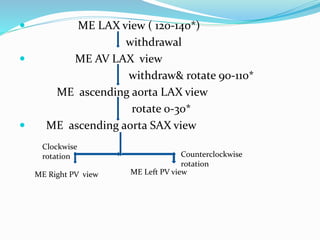  ME LAX view ( 120-140*)
withdrawal
 ME AV LAX view
withdraw& rotate 90-110*
ME ascending aorta LAX view
rotate 0-30*
 ME ascending aorta SAX view
ME Right PV view ME Left PV view
Clockwise
rotation Counterclockwise
rotation
 