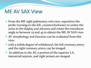 ME AV SAX View
 From the ME right pulmonary vein view, reposition the
probe (turning to the left, counterclockwise) to center the
aorta in the display and advance and rotate the transducer
angle to between 25 and 45 to obtain the ME AV SAX view.
 AV morphology and function can be evaluated from this
view.
 with a subtle degree of withdrawal, the left coronary artery
and the right coronary artery can be imaged.
 In addition to the AV, a portion of the superior LA,
interatrial septum, and right atrium are imaged.
 