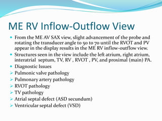 ME RV Inflow-Outflow View
 From the ME AV SAX view, slight advancement of the probe and
rotating the transducer angle to 50 to 70 until the RVOT and PV
appear in the display results in the ME RV inflow-outflow view.
 Structures seen in the view include the left atrium, right atrium,
interatrial septum, TV, RV , RVOT , PV, and proximal (main) PA.
 Diagnostic Issues
 Pulmonic valve pathology
 Pulmonary artery pathology
 RVOT pathology
 TV pathology
 Atrial septal defect (ASD secundum)
 Ventricular septal defect (VSD)
 