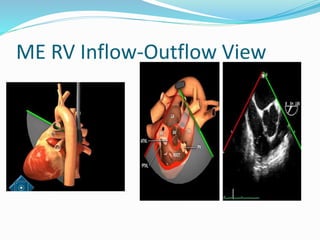 ME RV Inflow-Outflow View
 