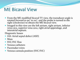 ME Bicaval View
 From the ME modified bicaval TV view, the transducer angle is
rotated forward to 90° to 110°, and the probe is turned to the
right (clockwise) to obtain the ME bicaval view.
 Imaged in this view are the left atrium, right atrium, inferior
vena cava, superior vena cava, right atrial appendage, and
interatrial septum.
Diagnostic Issues
 IAS: Atrial septal defect (ASD)
 Mass
 SVC/IVC flow
 Venous catheters
 Pacemaker wires
 Venous cannula position (SVC/IVC)
 